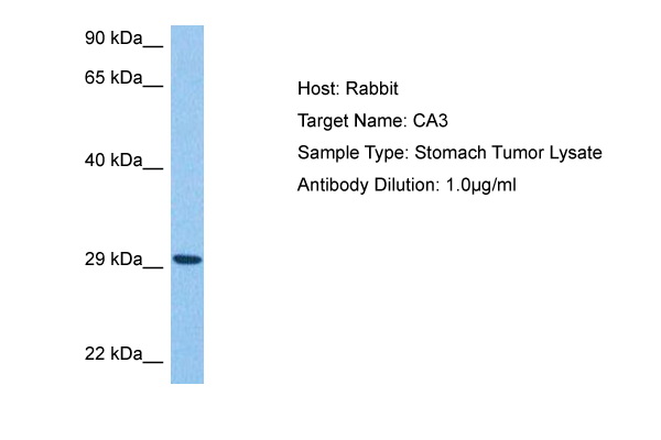 CA3 Antibody - N-terminal region (ARP79325_P050) in Human Stomach Tumor using Western Blot