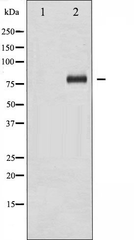 FOXO1 Antibody (Phospho-Ser329) (OAAJ02703) in HeLa whole cell lysates using Western Blot