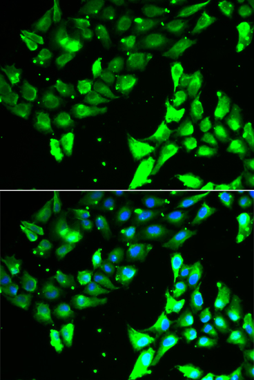 KIF2B Antibody (OAAN01843) in A549 Cells using Immunofluorescence