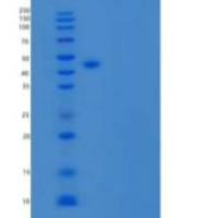 人Nogo-66受体/网状蛋白4受体重组蛋白