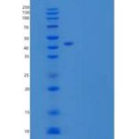 人羧肽酶B1(CPB1)重组蛋白C-6His