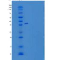 人半乳糖凝集素-8/LGALS8重组蛋白