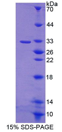 ABCB9 Recombinant Protein (OPCD00425) using SDS-PAGE