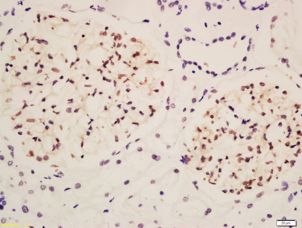 NPHS2 Antibody (OAAB21939) in DAB staining using Immunohistochemistry