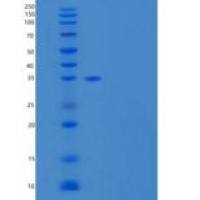 人结合蛋白-3/PVRL3/CD113重组蛋白C-6His