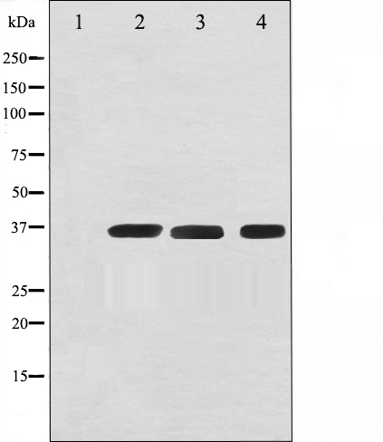 GAPDH Antibody (OAAJ02271) in Hela, Jurket, and COS-7 using Western Blot