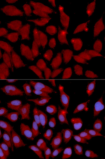 DNMT3A Antibody (OAAN00702) in U20S Cells using Immunofluorescence