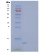 人分泌型跨膜蛋白1重组蛋白