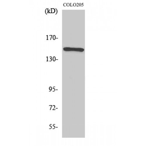 RAD50 Antibody - middle region (OASG06204) in COLO205 using Western Blot