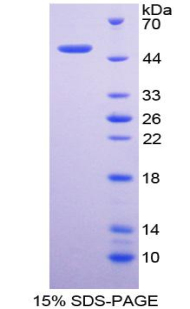 DLK1 Recombinant Protein (OPCD02760) using SDS-PAGE
