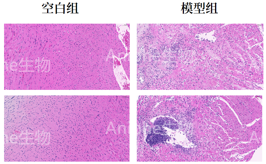 【免费检测超声】心肌梗死(MI)小鼠模型 MI模型 心梗模型
