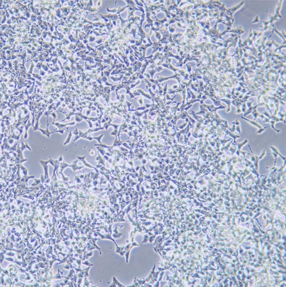 INS-1 大鼠胰岛细胞瘤细胞/STR鉴定/镜像绮点（Cellverse）