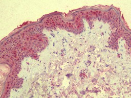 ANKLE2 Antibody (OALA09241) in Human Skin using ELISA