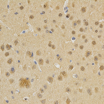 DNMT3A Antibody (OAAN00702) in Mouse Brain using Immunohistochemistry