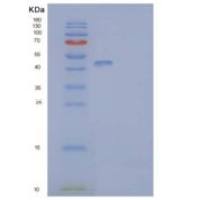 人t淋巴细胞表面抗原Ly-9/SLAMF3/CD229重组蛋白C-6His