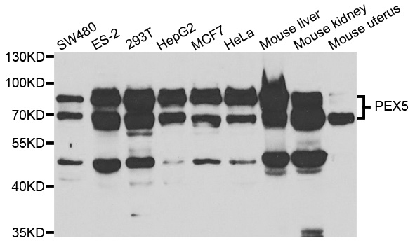 PEX5 Antibody (OAAN01526) in Multiple Cell Lines using Western Blot