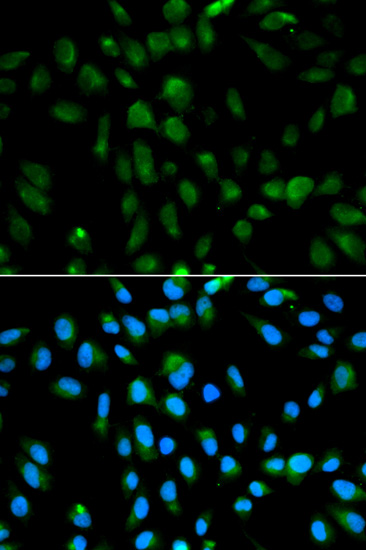 PSMA3 Antibody (OAAN00319) in MCF7 Cells using Immunofluorescence
