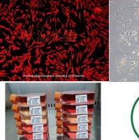 KTC-1细胞|KTC-1人甲状腺癌细胞|人甲状腺癌细胞