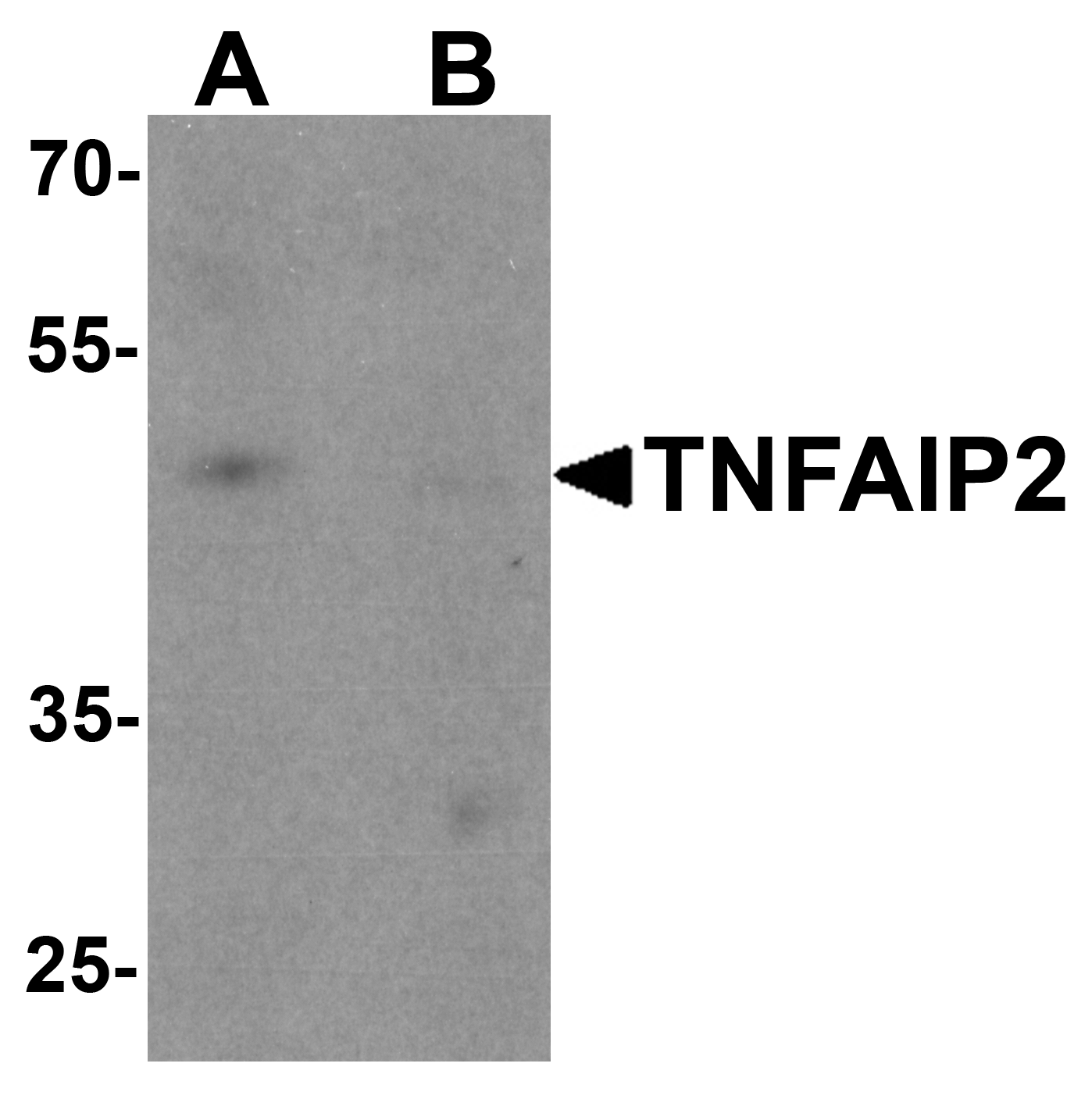 TNFAIP2 Antibody - N-terminal (OAPB01654) in K562 cell lysate using Western Blot