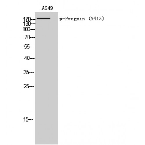 SGK223 Antibody (Phospho-Tyr413) (OASG06051) in A549 using Western Blot