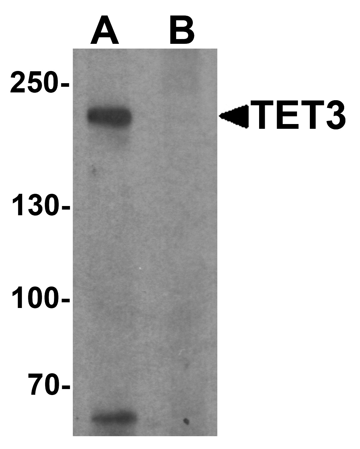 TET3 Antibody - C-terminal (OAPB01637) in SK-N-SH cell lysate using Western Blot
