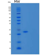 人接粘附分子B/JAM-B/CD322重组蛋白C-6His