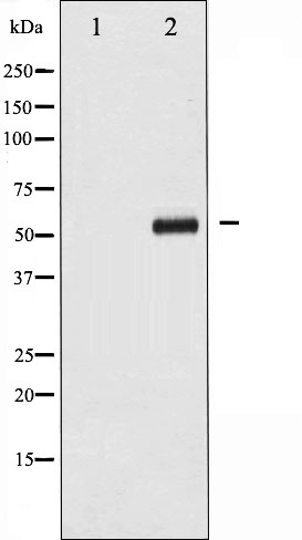 MYC Antibody (Phospho-Thr58) (OAAJ02345) in Ovary cancer whole cell lysates using Western Blot