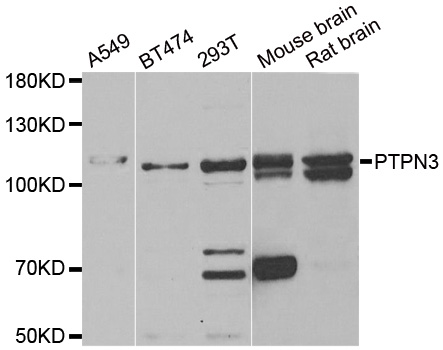 PTPN3 Antibody (OAAN01781) in Multiple Cell Lines using Western Blot