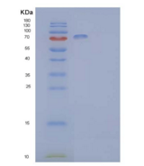 人肝配蛋白B型受体2重组蛋白