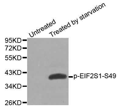 EIF2S1 Antibody (Phospho-Ser49) (OAAN02976) in HeLa Cells using Western Blot