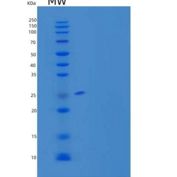 大鼠M-CSF/CSF1重组蛋白