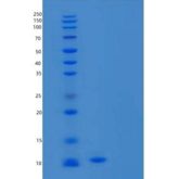 人Cystatin A重组蛋白N-6His
