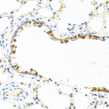 APCS Antibody (OAAN00656) in Rat Lung using Immunohistochemistry