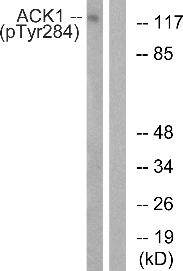 TNK2 Antibody (Phospho-Tyr284) (OAAB20039) in Human HepG2 Cells using Western Blot