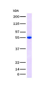 DLL1 Recombinant Protein (Human) (OPBG00104) using SDS-PAGE