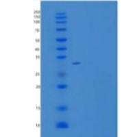 人LAMP2/CD107b重组蛋白C-6His