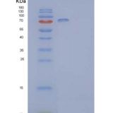 人肝配蛋白B型受体2重组蛋白