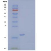 人髓细胞触发受体2(TREM2)重组蛋白C-6His