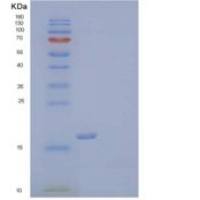 人髓细胞触发受体2(TREM2)重组蛋白C-6His