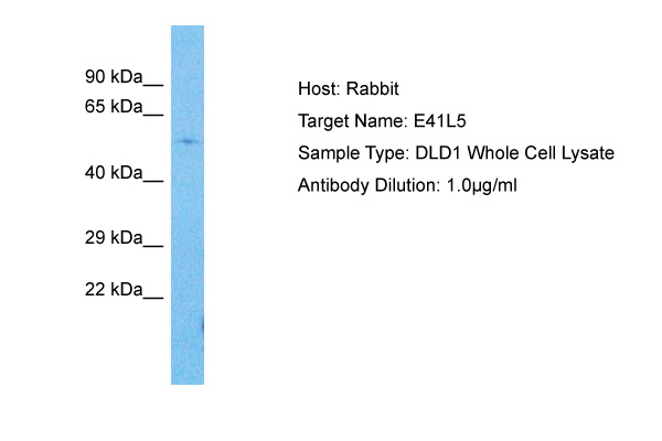 EPB41L5 Antibody - middle region (ARP77593_P050) in Human DLD1 Whole Cell using Western Blot