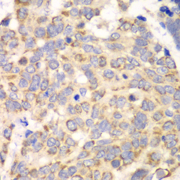 HAGH Antibody (OAAN01906) in Human Esophagus using Immunohistochemistry