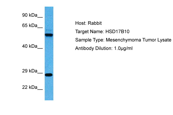 HSD17B10 Antibody - middle region (ARP81402_P050) in Human Mesenchymoma Tumor using Western Blot