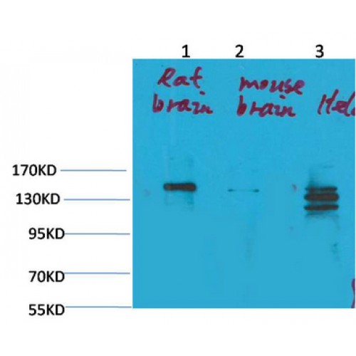 SLC12A4 Antibody (Asp248) (OASG06667) in HeLa using Western Blot