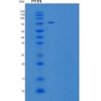 人神经连接蛋白1(NLGN1)重组蛋白C-6His