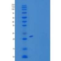 人CLEC3B/Tetranectin重组蛋白C-6His
