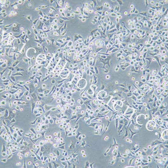 SNU601 人胃癌细胞/SNU-601细胞/SNU-601/SNU601细胞/SNU601/STR鉴定/镜像绮点(Cellverse)