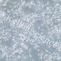 SNU601 人胃癌细胞/SNU-601细胞/SNU-601/SNU601细胞/SNU601/STR鉴定/镜像绮点（Cellverse）