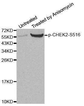 CHEK2 Antibody (Phospho-Ser516) (OAAN02966) in A549 Cells using Western Blot