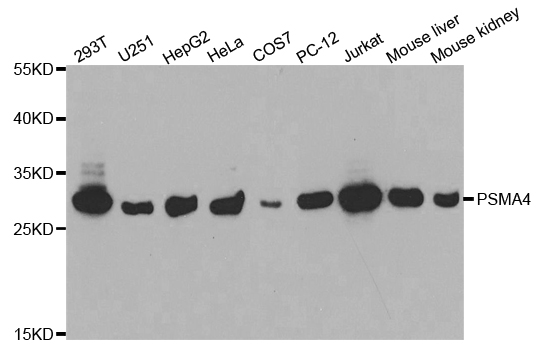 PSMA4 Antibody (OAAN00860) in Multiple Cell Lines using Western Blot