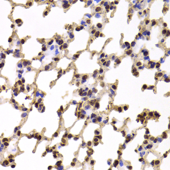 KIF2B Antibody (OAAN01843) in Mouse Lung using Immunohistochemistry
